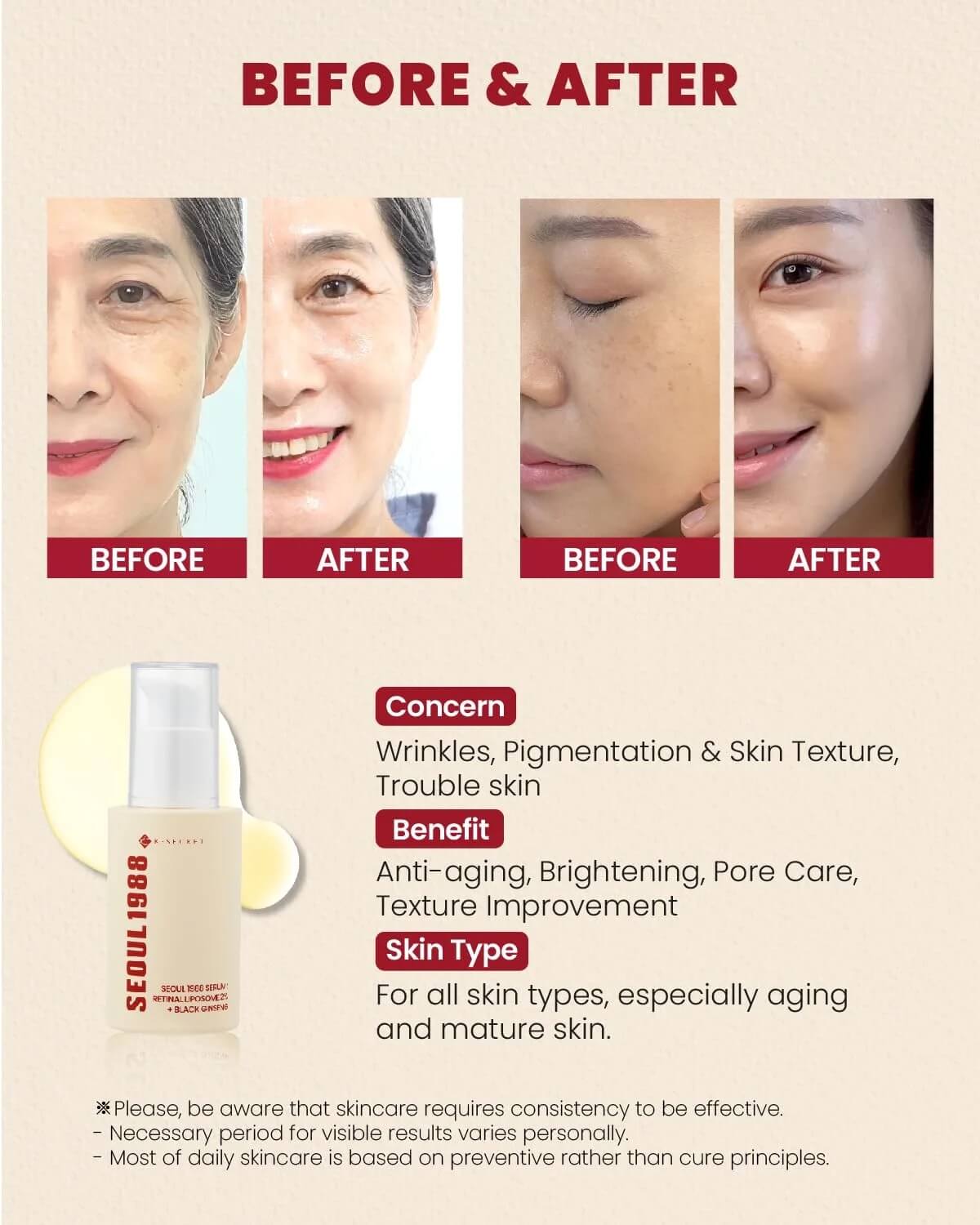 KSECRET SEOUL1988 Serum: Retinal Liposome 2% + Black Ginseng (30ml)